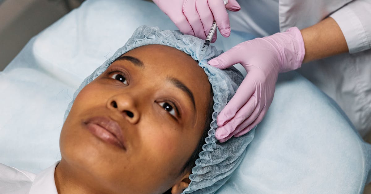Treating Crow's Feet with Botox: A Comprehensive Guide