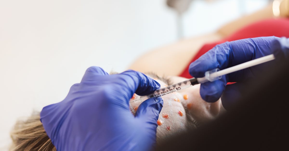 Understanding the Common Side Effects of Botox Injections