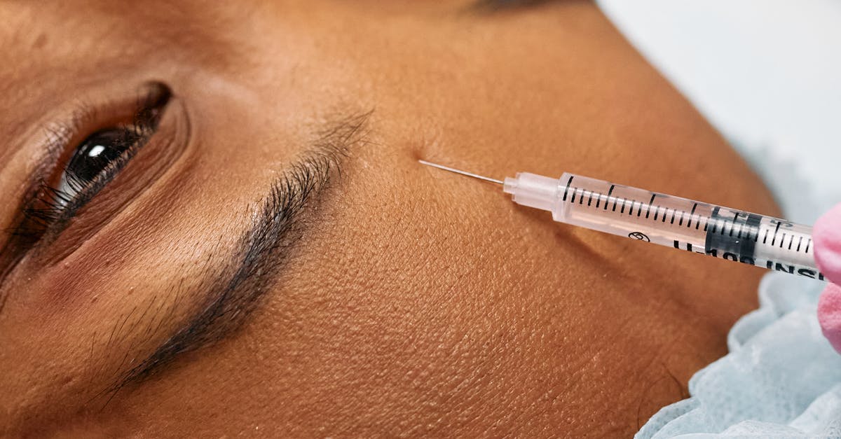 When to Be Concerned About Botox Side Effects